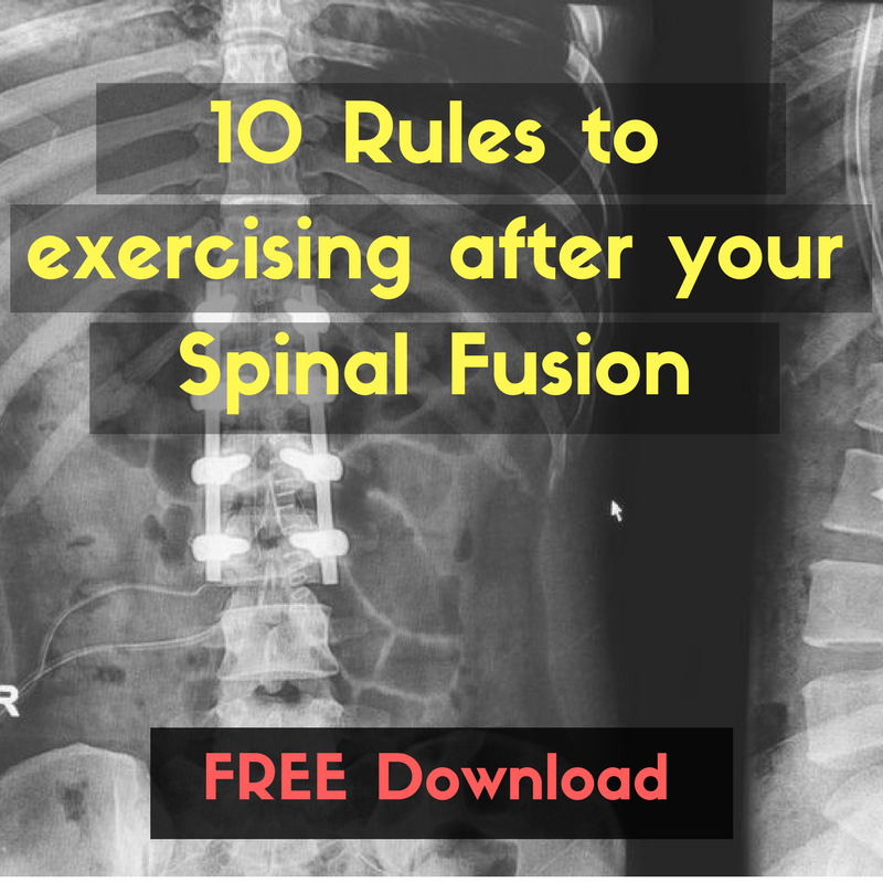 Exercise Program Exercise Program After Spinal Fusion