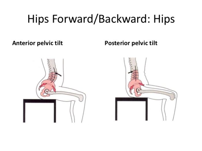 Your Premium StepbyStep Guide to Fixing Anterior Pelvic Tilt
