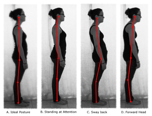 What are posture exercises to improve rounded shoulders?