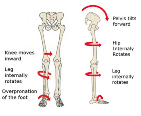 Flat foot back pain sale