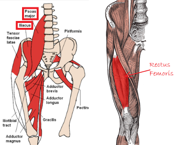 fixing anterior pelvic tilt