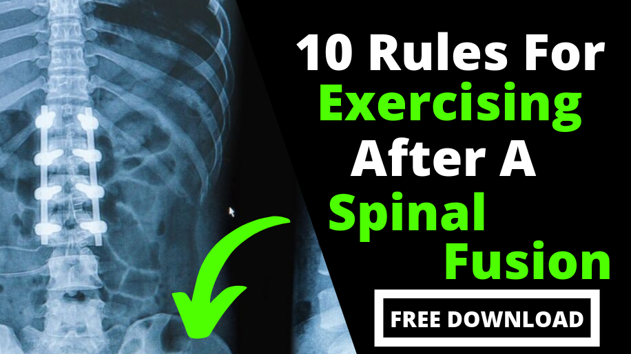 What is Lumbar Spine Degenerative Disc Disease & How to Manage? - Upswing  Health