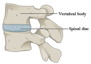 5 Things You Must Avoid if You're Dealing With Morning Back Pain - Fitness  4 Back Pain