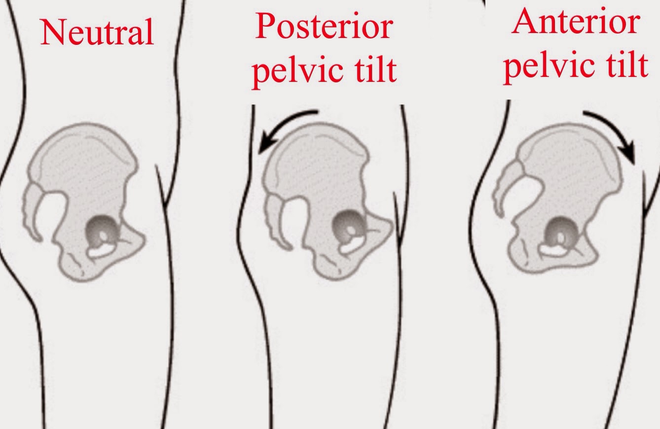 Pelvic-tilt