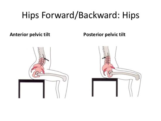 Your Premium Step-by-Step Guide to Fixing Anterior Pelvic Tilt